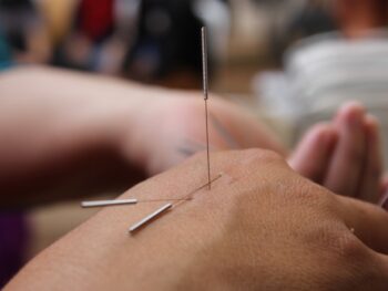 The 3 Important Steps To Set Up An Acupuncture Studio