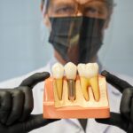 4 Benefits of Getting Dental Implants in Port Charlotte, FL