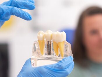 How Dental Implants Improve Teeth’s Appearance