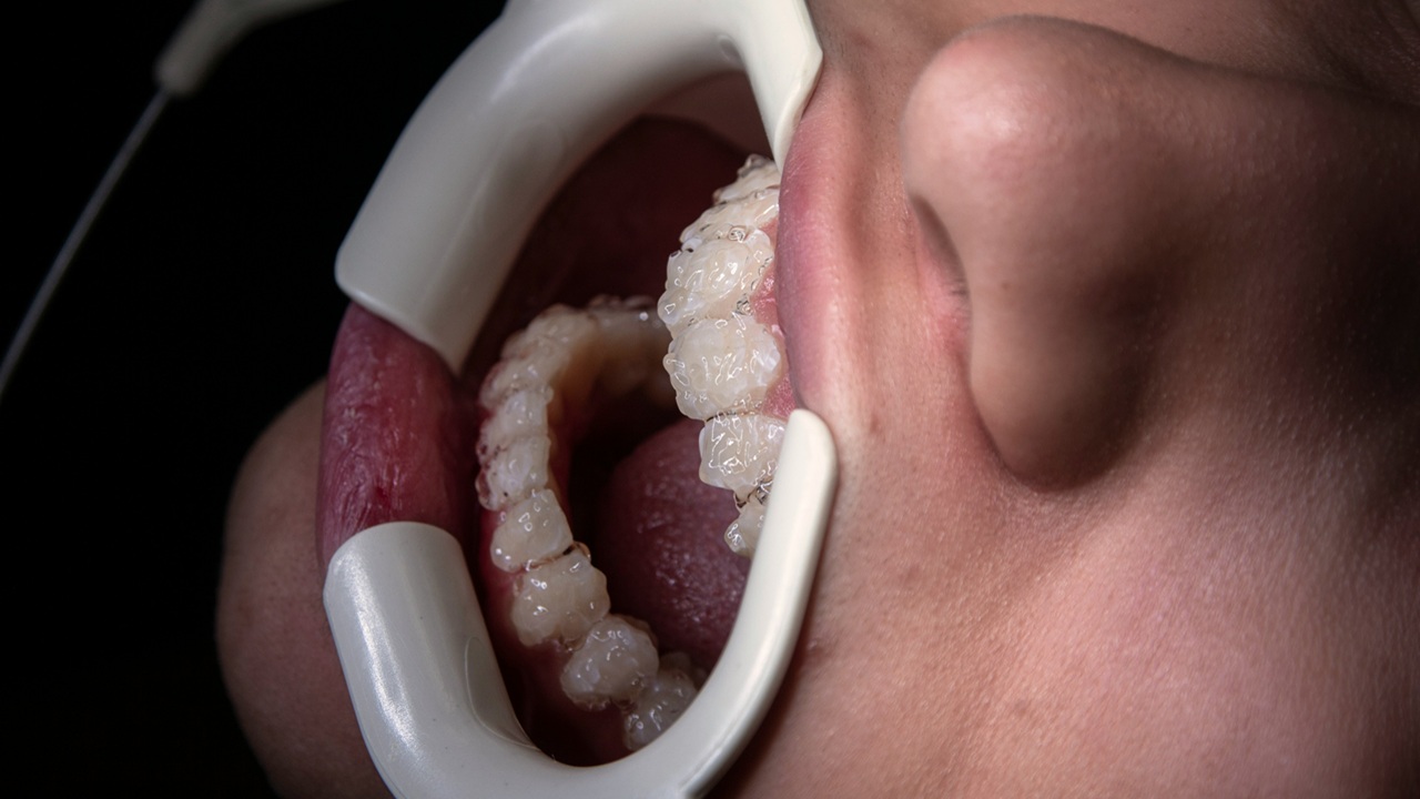 Revealed: DIY Hacks That Make Healthcare Affordable