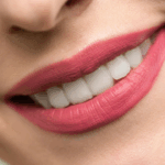 The Complete Smile Transformation: How Full Mouth Implants Change Lives