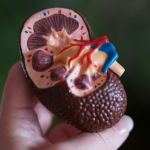 Foods That May Help Reduce the Risk of Kidney Stones Naturally