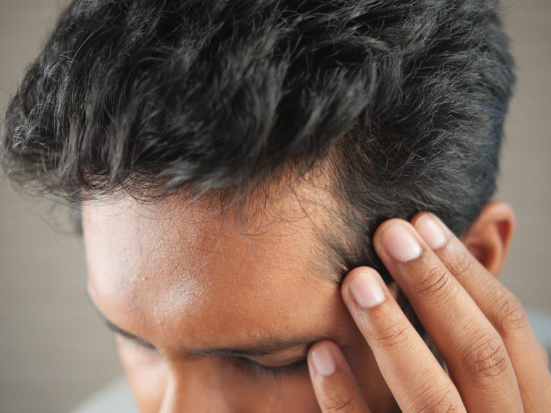 Thinning Hair Tips: What Does And Doesn't Work