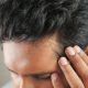 Thinning Hair Tips: What Does And Doesn't Work