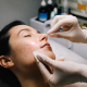 Acne Scar Treatment in Singapore Prices, Procedures, and What to Expect
